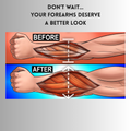 Arm Buddy - Forearm Trainer